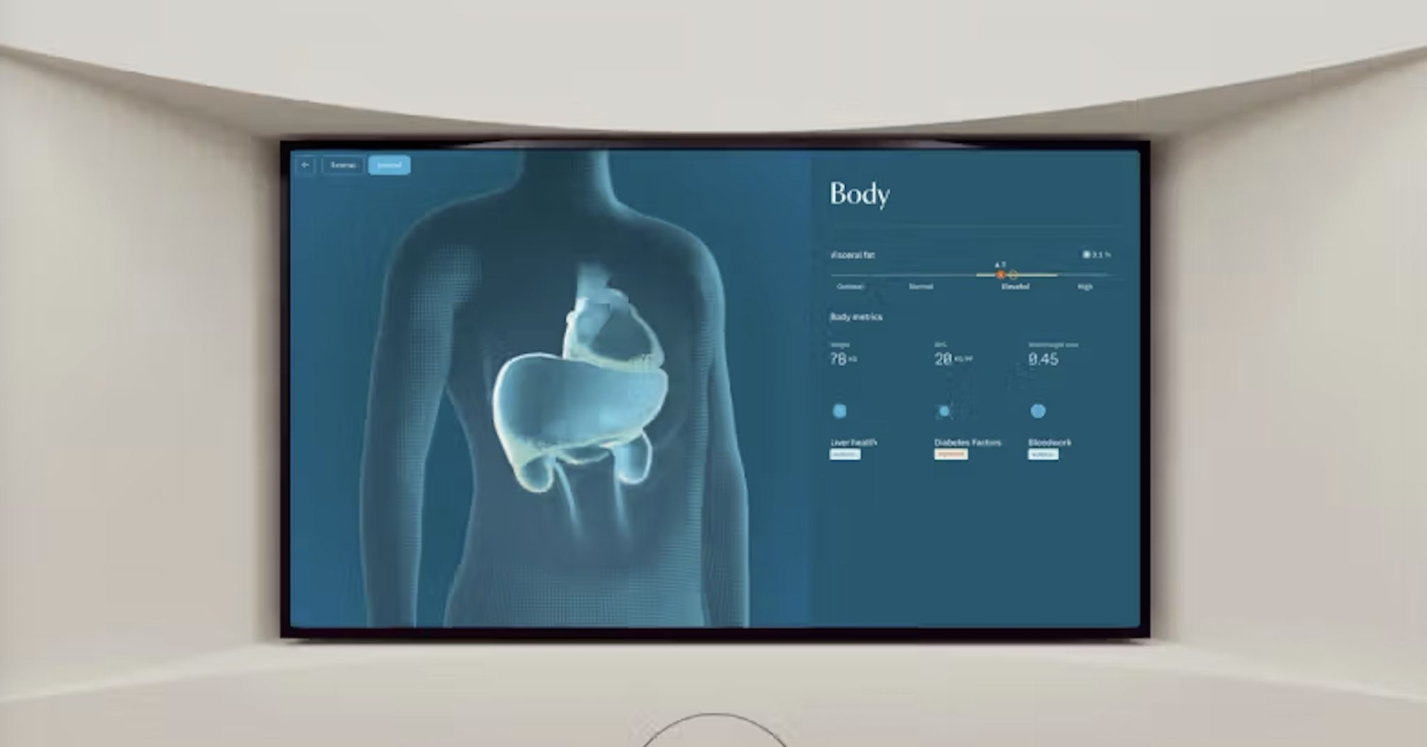Neko raises $700M to take preventive health scans to America