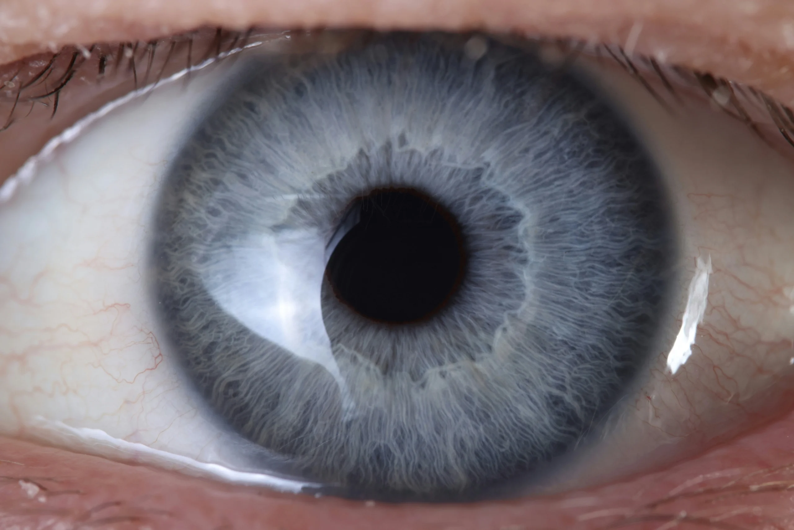 Breye Raises €67.5M for Retinal Disease Drugs