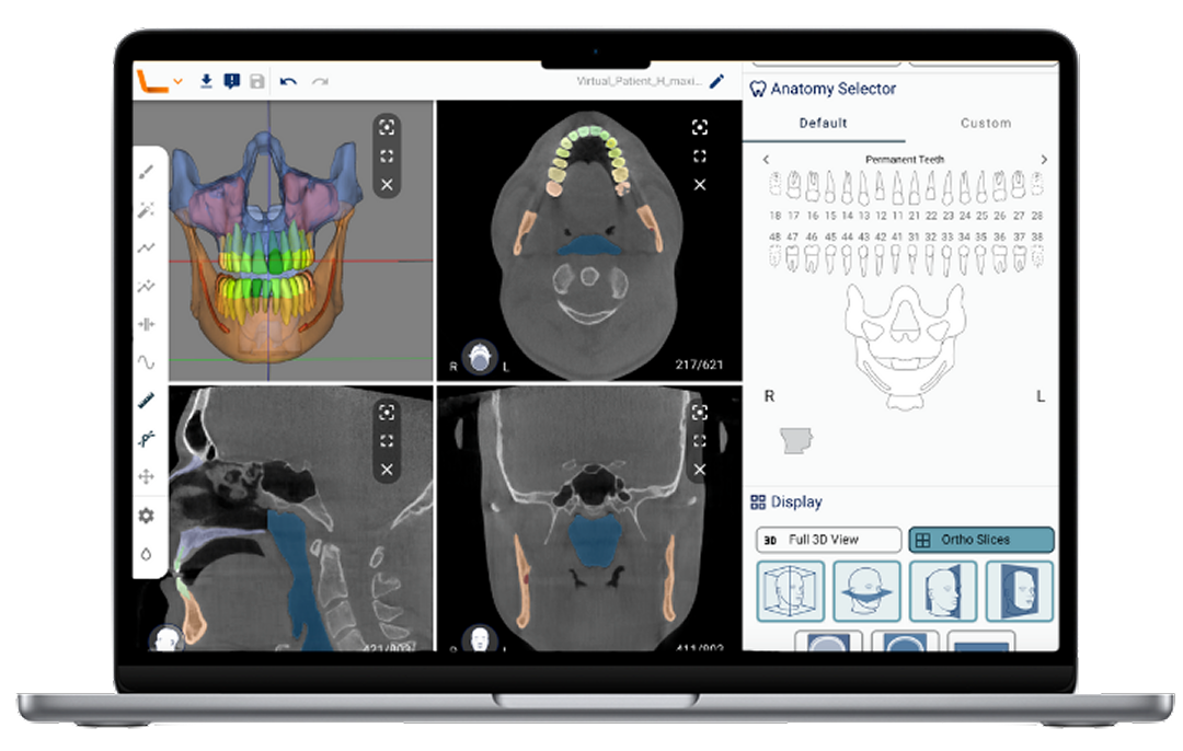 Relu raises €1.51M for dental AI