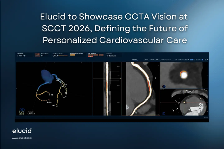 Elucid Raises $55M for Heart Imaging