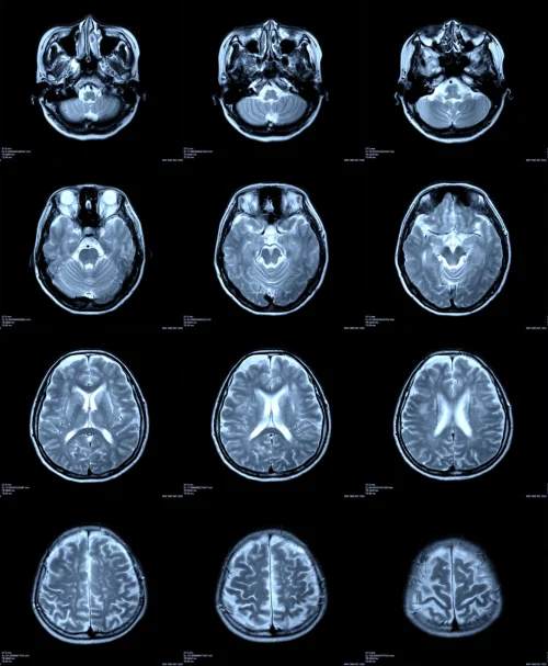 Scan.com Raises $220M for Medical Imaging