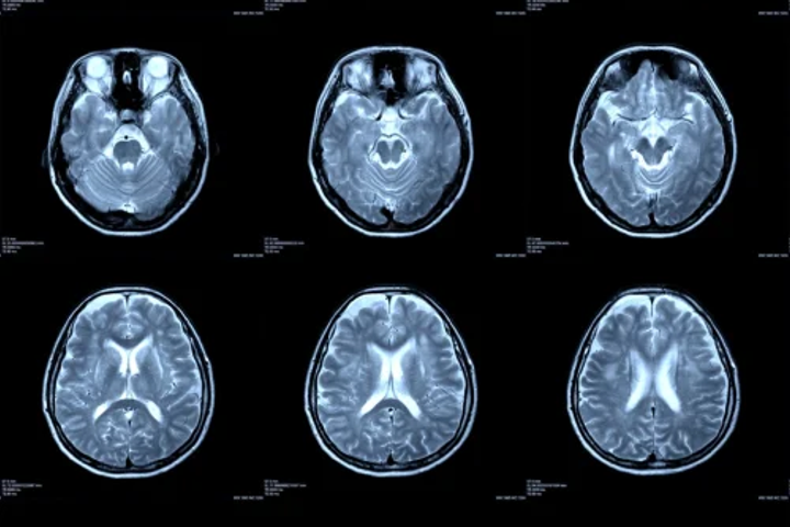 Scan.com Raises $220M for Medical Imaging