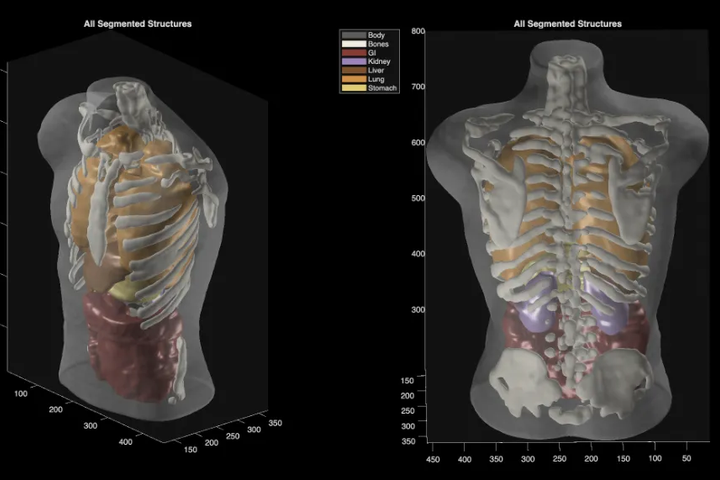 Midjourney Medical shows AI labs are getting weirdly ambitious