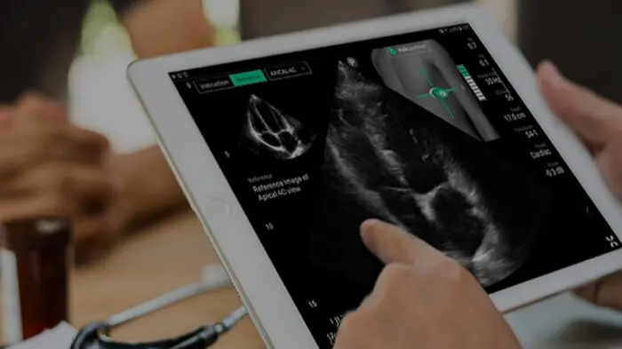 UltraSight Raises $24M for AI Cardiac Imaging