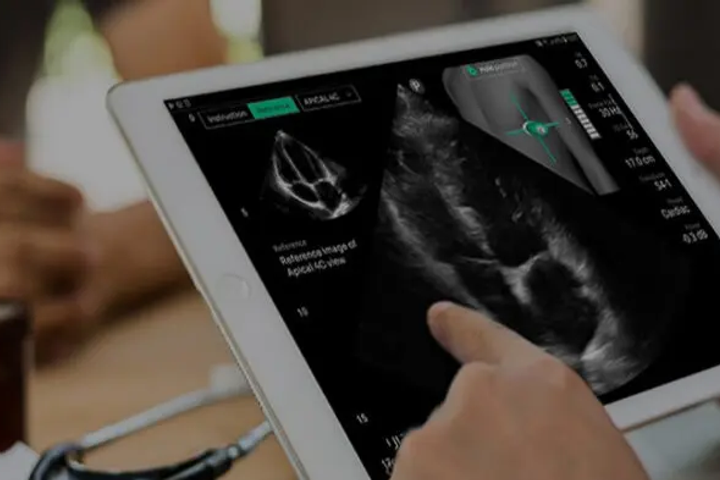 UltraSight Raises $24M for AI Cardiac Imaging