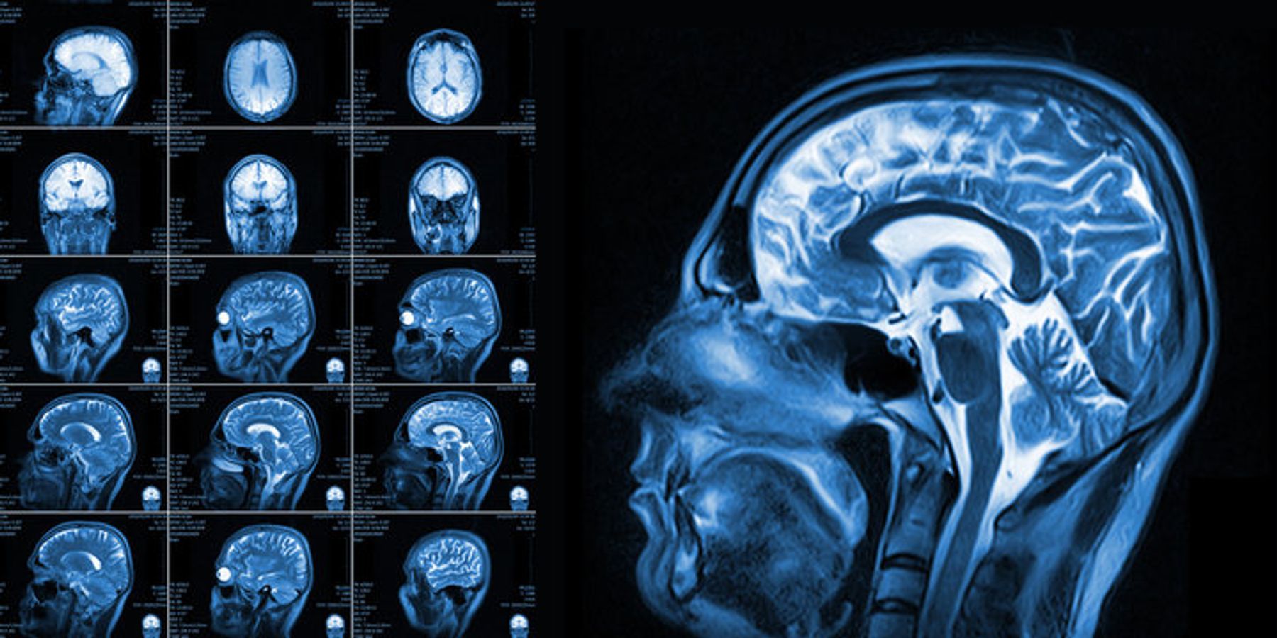 MRI Scan Report