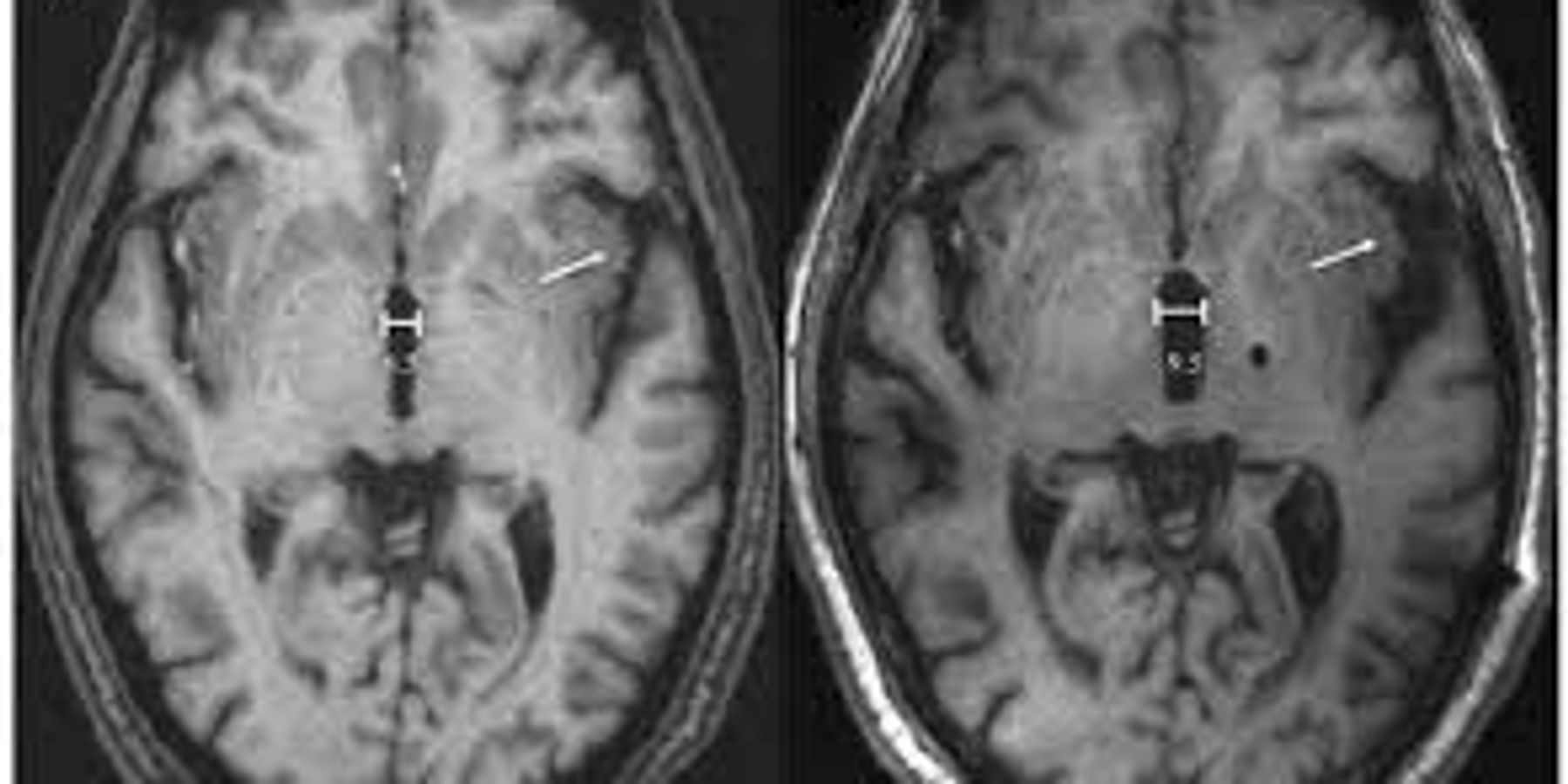 Comparison of two medical reports - MRI Scan reports
