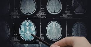 Urgent MRI Scan Report