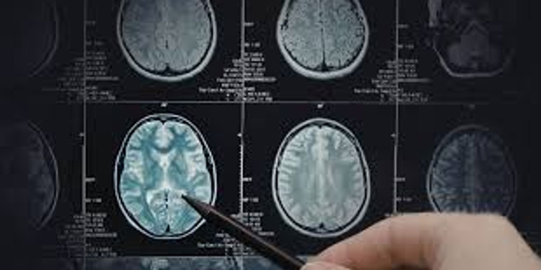 Urgent MRI Scan Report