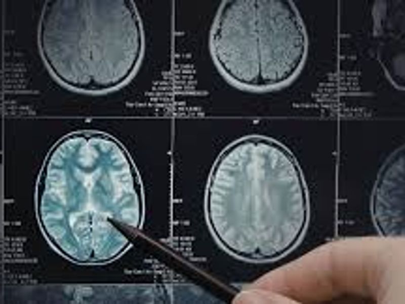Urgent MRI Scan Report