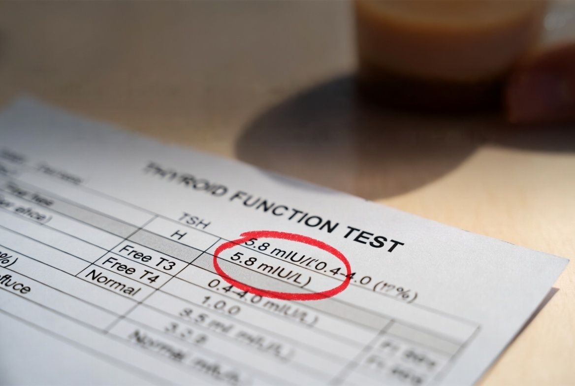 Thyroid Test Results – TSH, T3, T4 Explained Simply