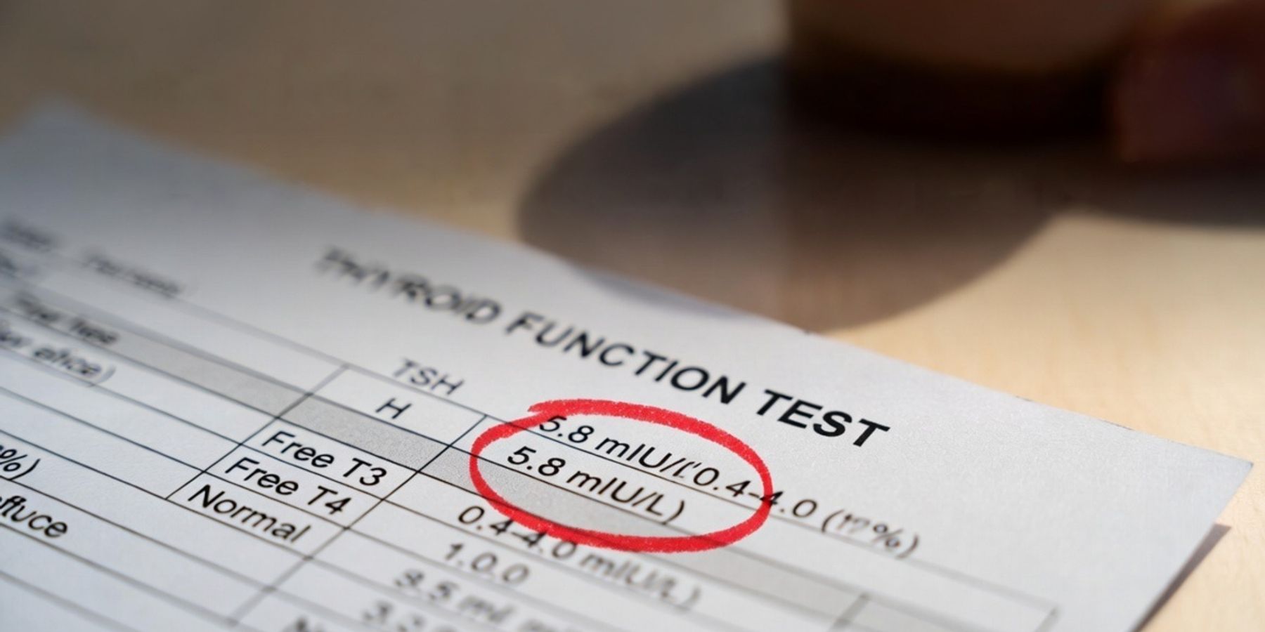 Thyroid Test Results – TSH, T3, T4 Explained Simply