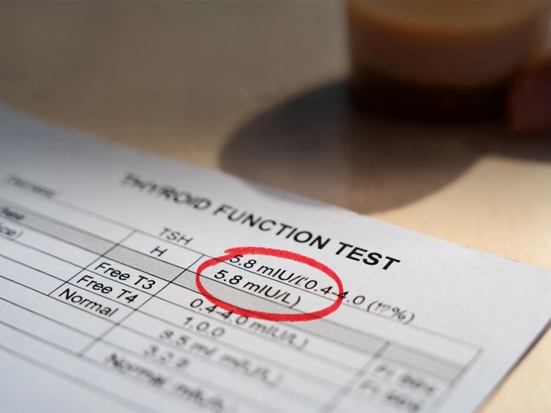 Thyroid Test Results – TSH, T3, T4 Explained Simply