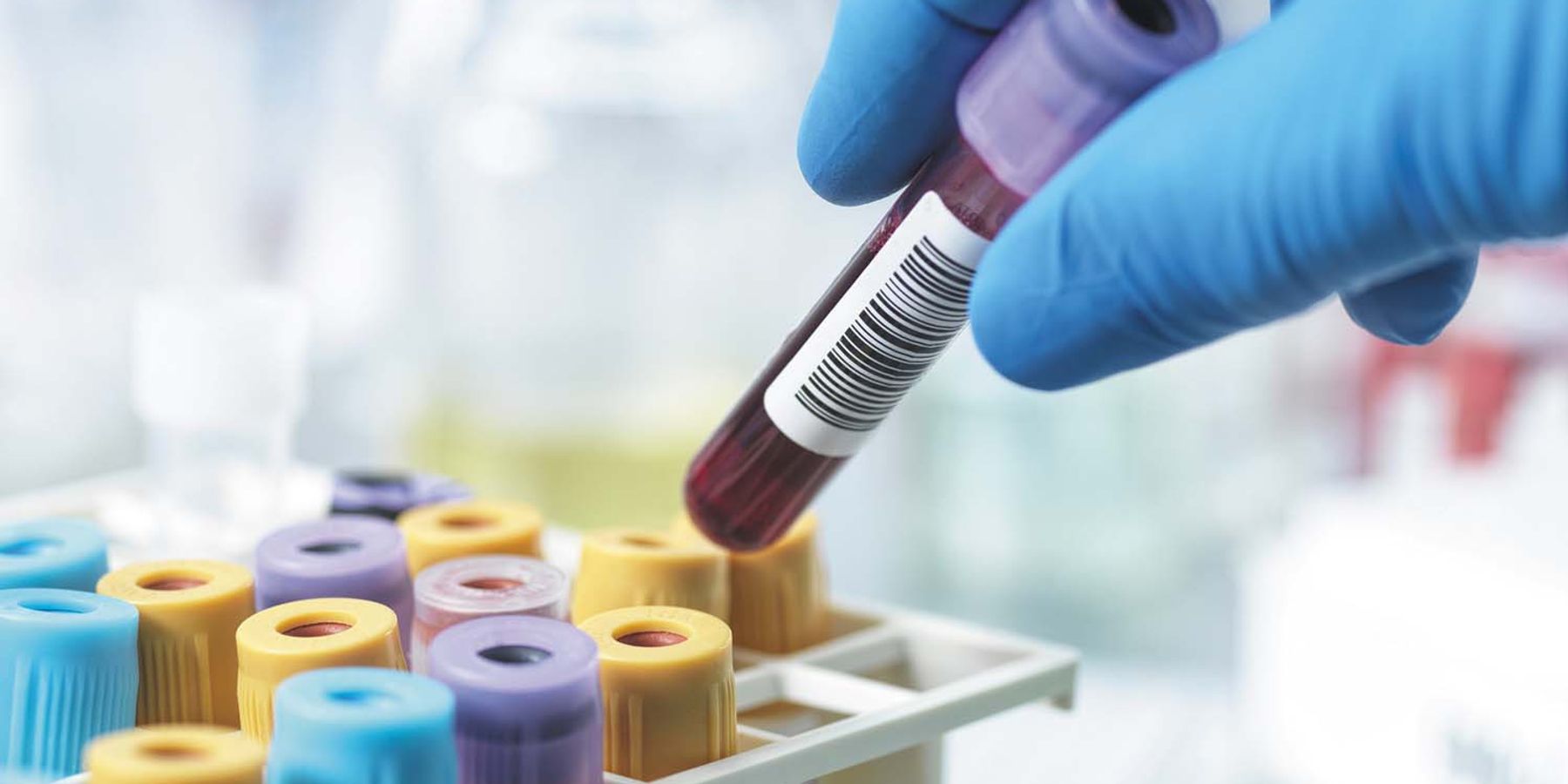 How to read and understand a Blood Test.