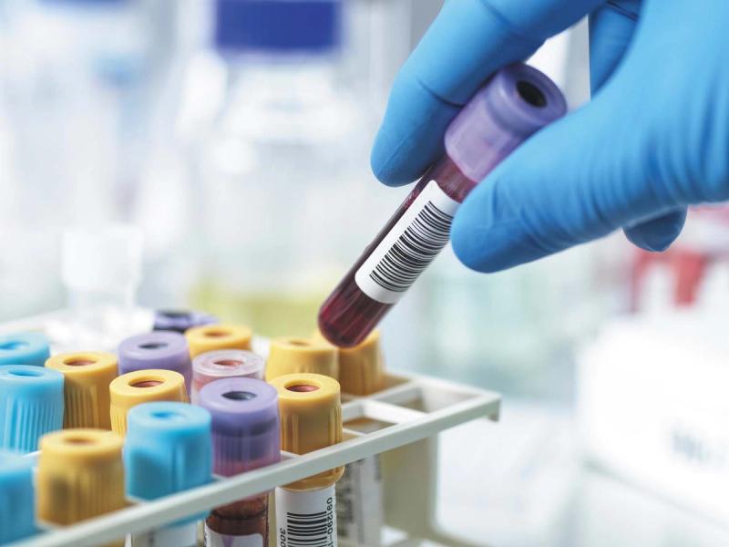 How to read and understand a Blood Test.