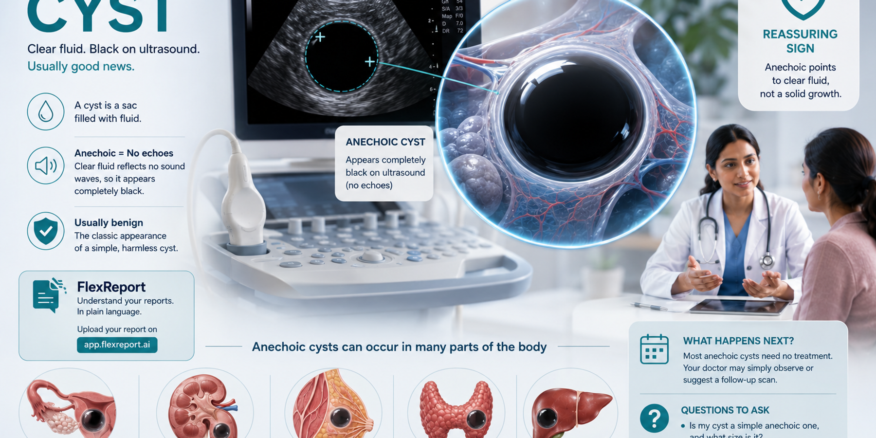 Anechoic Cyst: What It Means on Your Ultrasound Report