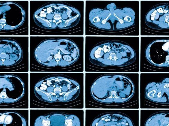 incidental findings in a medical report 