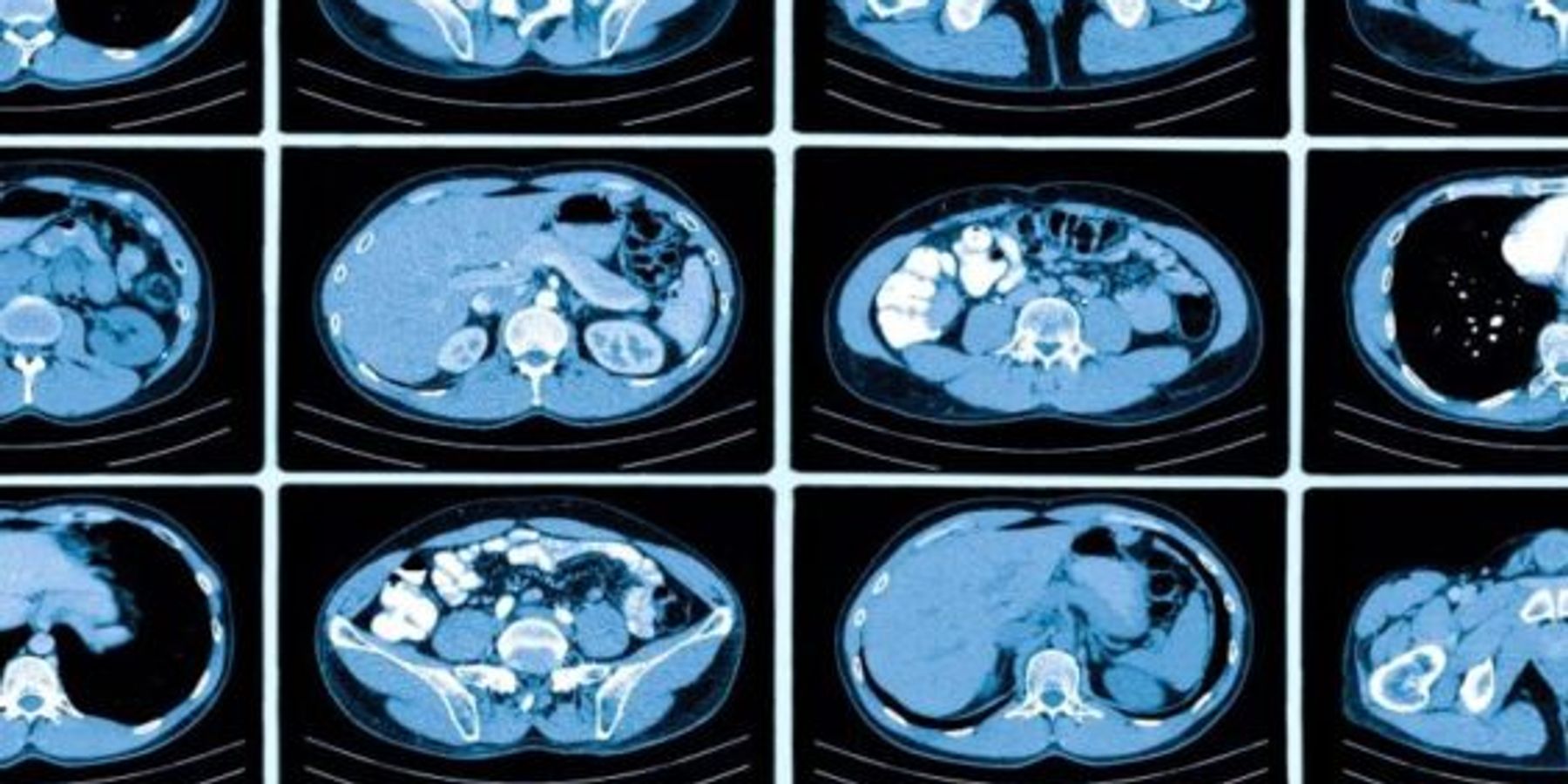 incidental findings in a medical report
