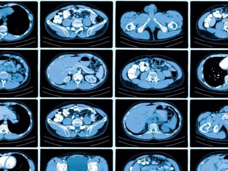 incidental findings in a medical report