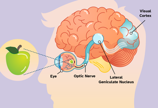 A diagram of the eye and brain, showing the optic nerve connected to the visual cortex.