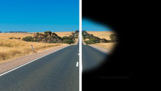 An image of a road with the right side showing the effects of retinitis pigmentosa