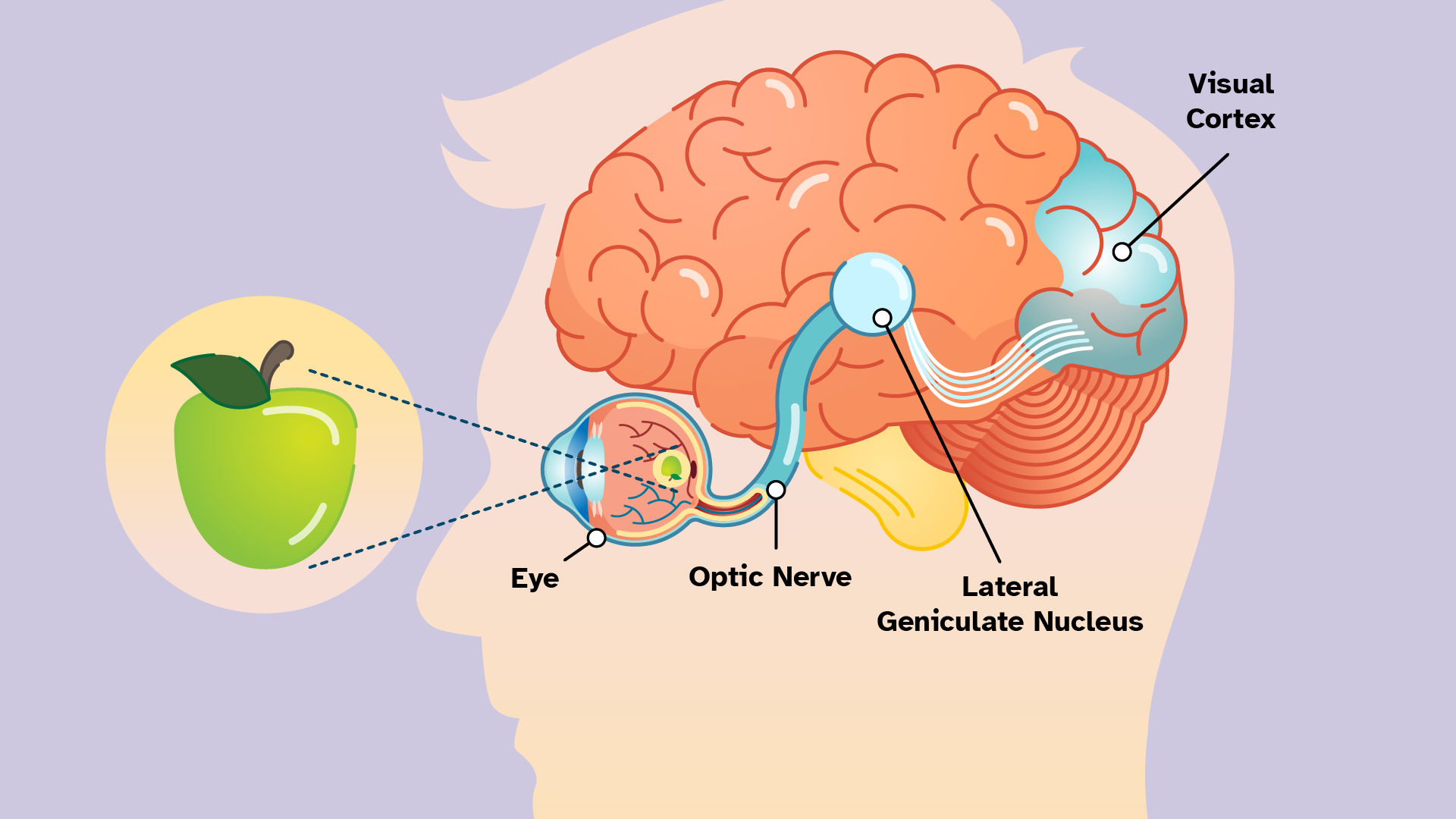 A diagram of the eye and brain, showing the optic nerve connected to the visual cortex.