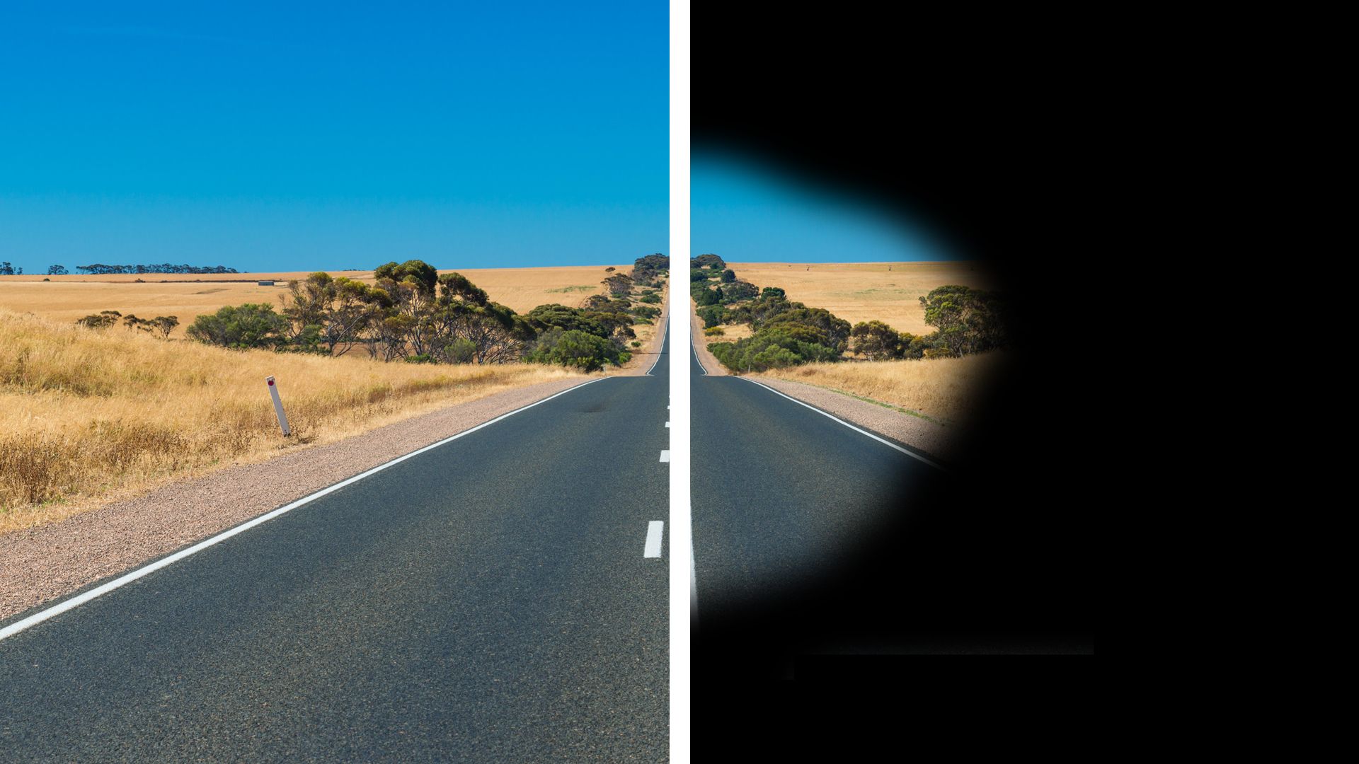 An image of a road with the right side showing the effects of retinitis pigmentosa