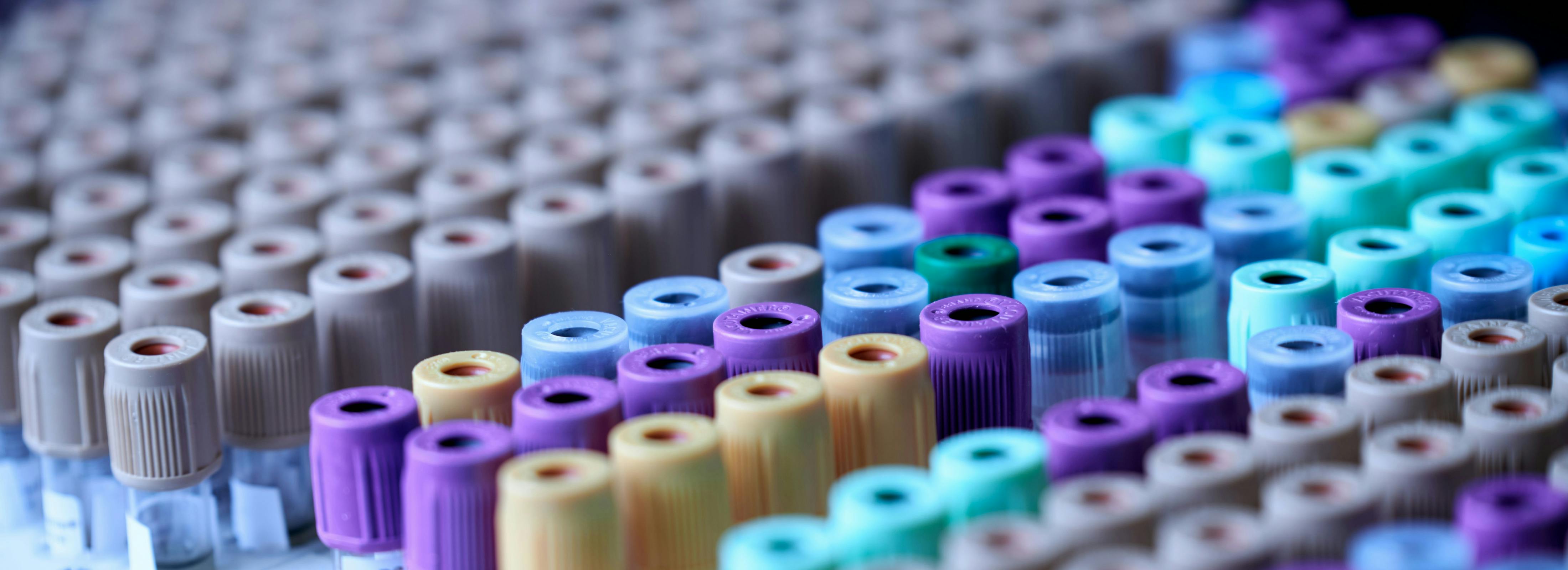 Private credit preps $9bn Hologic financing to rival BSL offering for LBO