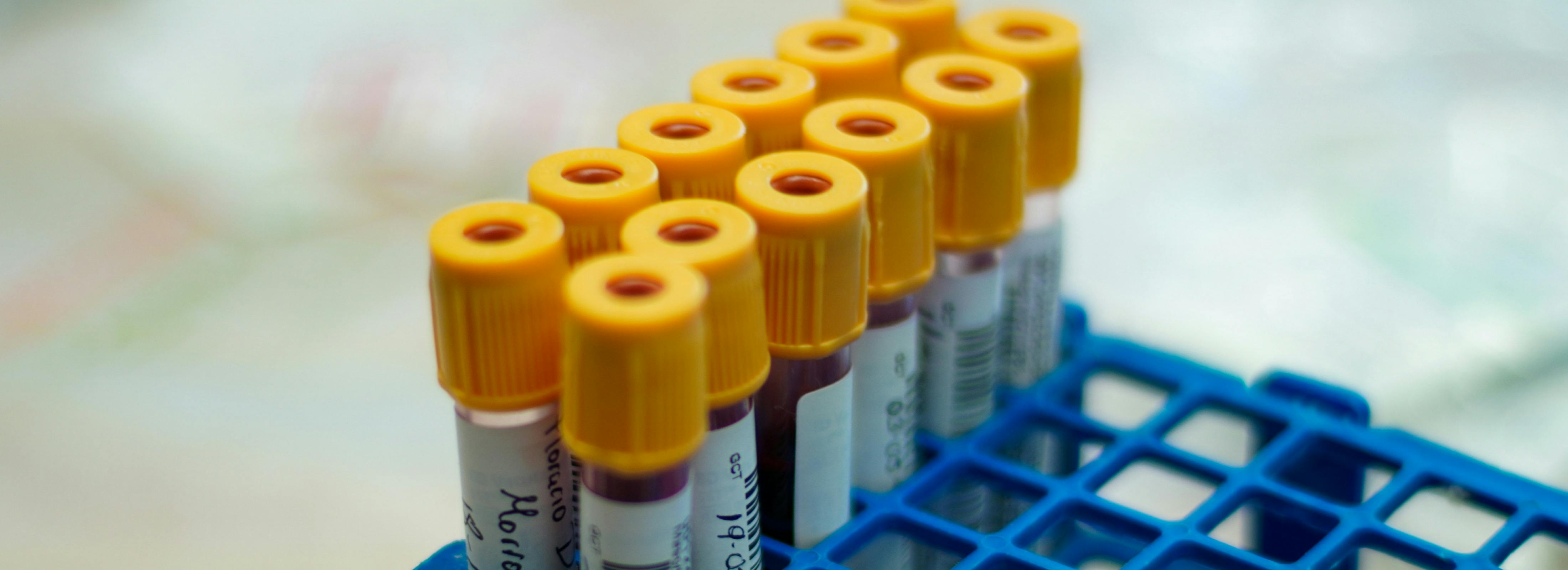 KKR pulls GPI bid, BC Partners jumps in