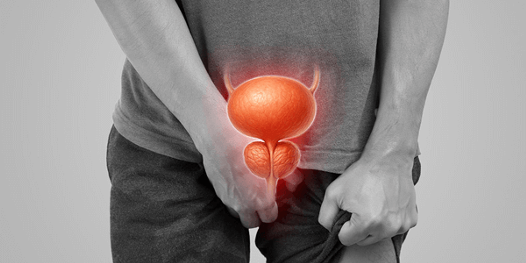 Férfi fájdalmában az ágyékát és a nadrágját szorítja, felette prosztata ikon