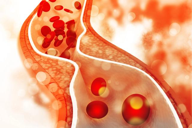 Does Mounjaro Lower Cholesterol