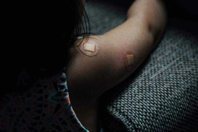 Does Semaglutide Cause Bruising & What Can I Do to Reduce It?