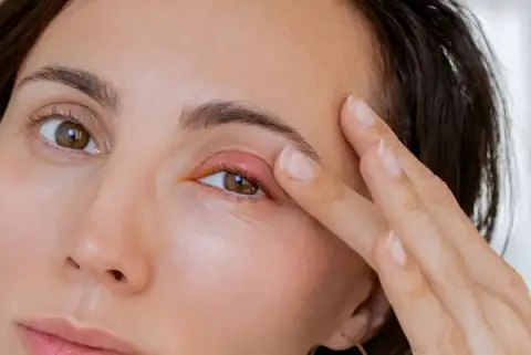 How Semaglutide Eye Side Effects Happen and What To Do