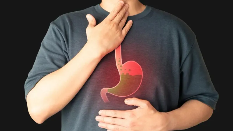 How to Prevent and Treat Wegovy Sulfur Burps