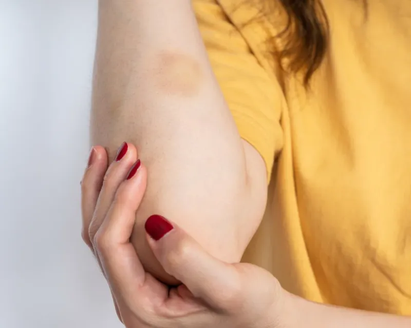 Can Tirzepatide Cause Blood Clots