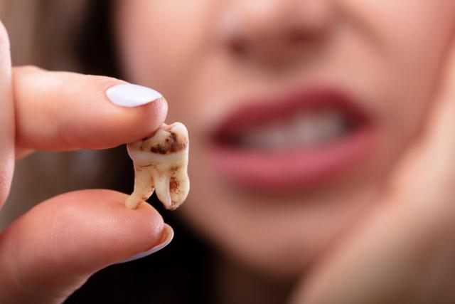 Does Ozempic Cause Tooth Decay