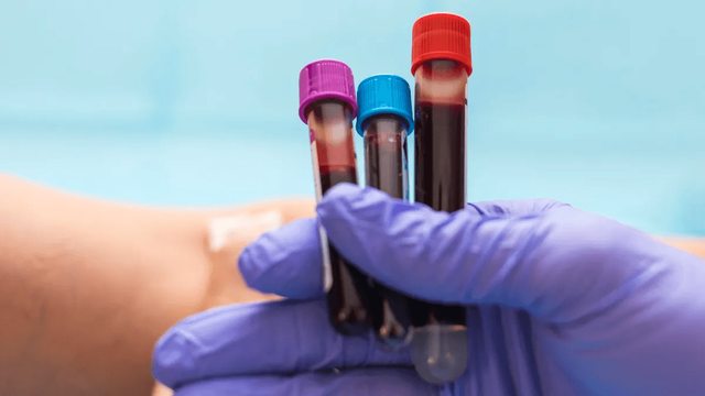 When Semaglutide Is Tested for
