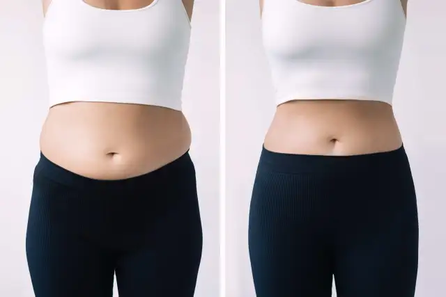 Real GLP 1 Before and After Results and Why They Vary So Much