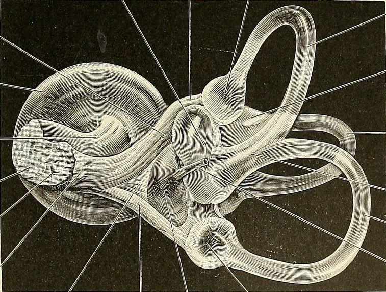 Superior Semisirküler Kanal Dehissansı (SSCD), iç kulakta superior yarım daire kanalının üzerindeki kemik yapısının incelmesi veya dehise olmasıyla ortaya çıkan nadir bir hastalıktır. Vestibüler ve işitsel semptomlara yol açan SSCD, 3. pencere etkisi yaratarak iletim tipi işitme kaybı, otofoni, osilopsi ve pulsatil tinnitus gibi belirtilere neden olabilir. Teşhis sürecinde saf ses odyometrisi, VEMP testi ve bilgisayarlı tomografi önemli rol oynar. Tedavi başlangıçta konservatif yaklaşımı içerirken, ileri vakalarda cerrahi seçenekler değerlendirilebilir.