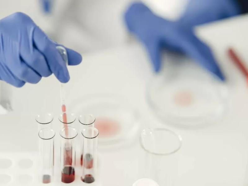 Америкт 50 төрлийн хорт хавдрыг илрүүлэх чадвартай цусны шинжилгээг туршсан гайхалтай үр дүн