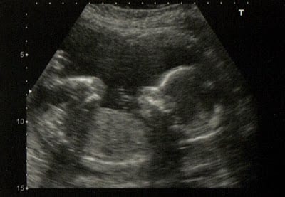 Productive Muslimah Pregnancy Diaries: Second Trimester