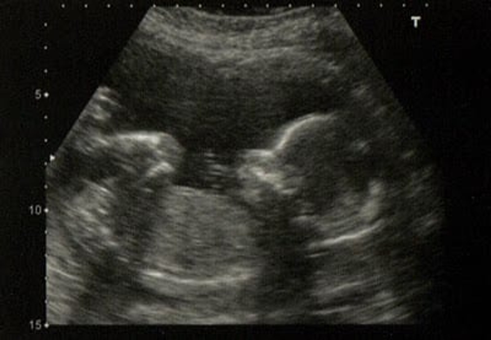 Productive Muslimah Pregnancy Diaries: Second Trimester
