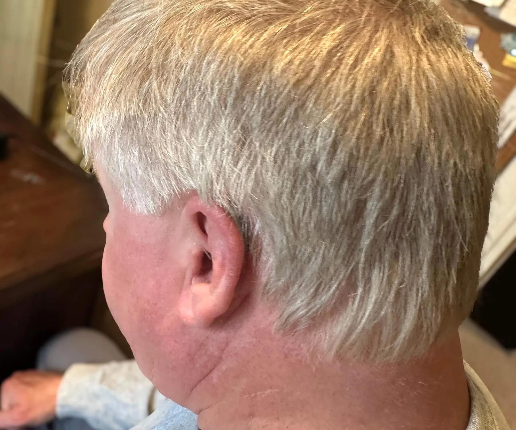 Hearing aid fitting with Real Ear Measurement