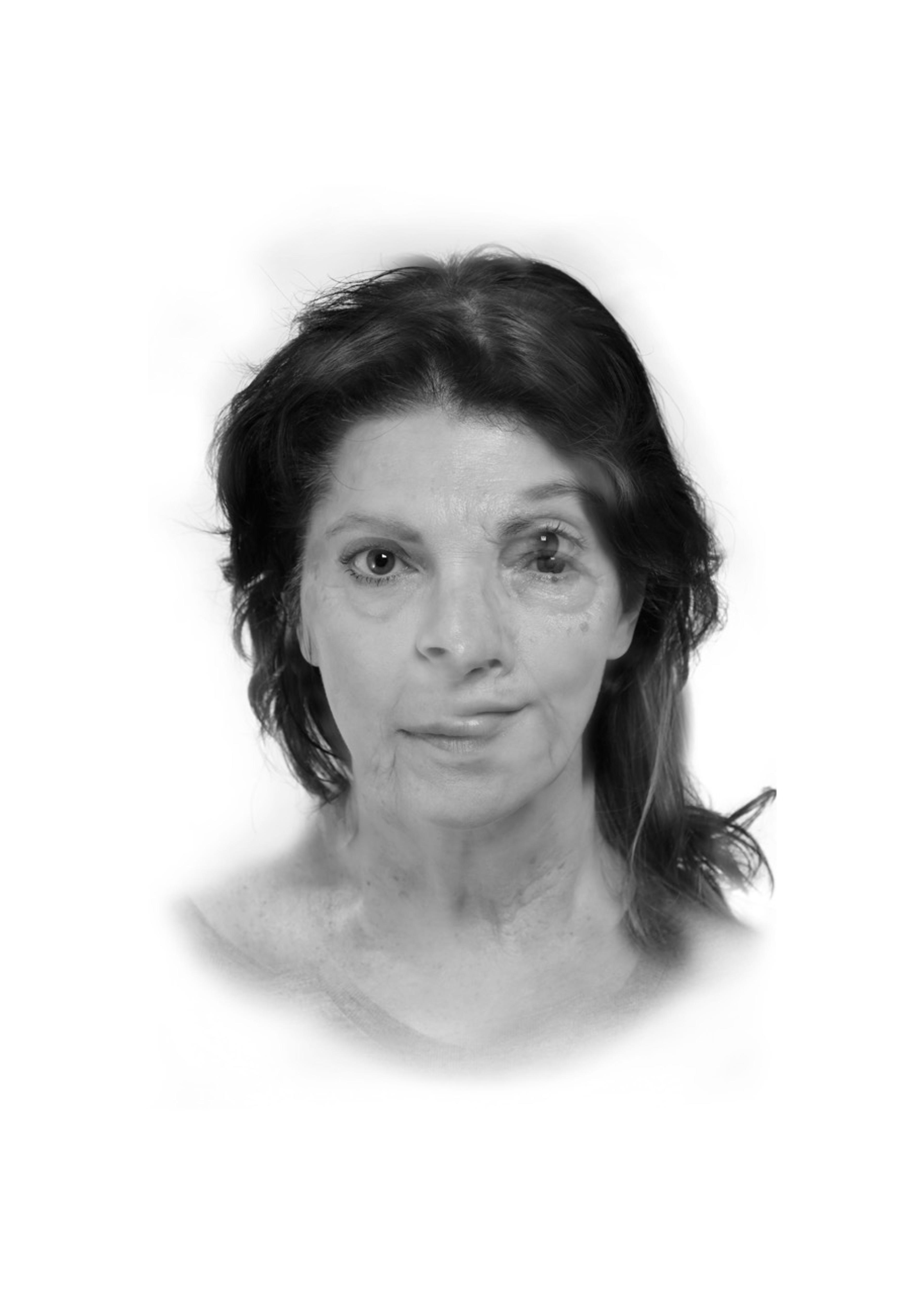 Black and white portrait of a woman with dark hair, digitally manipulated with overlapping facial features creating a double-exposure effect. The artwork explores themes of identity, self-image, and the passage of time. Part of Šejla Kamerić’s Ex You Portrait series (2025).