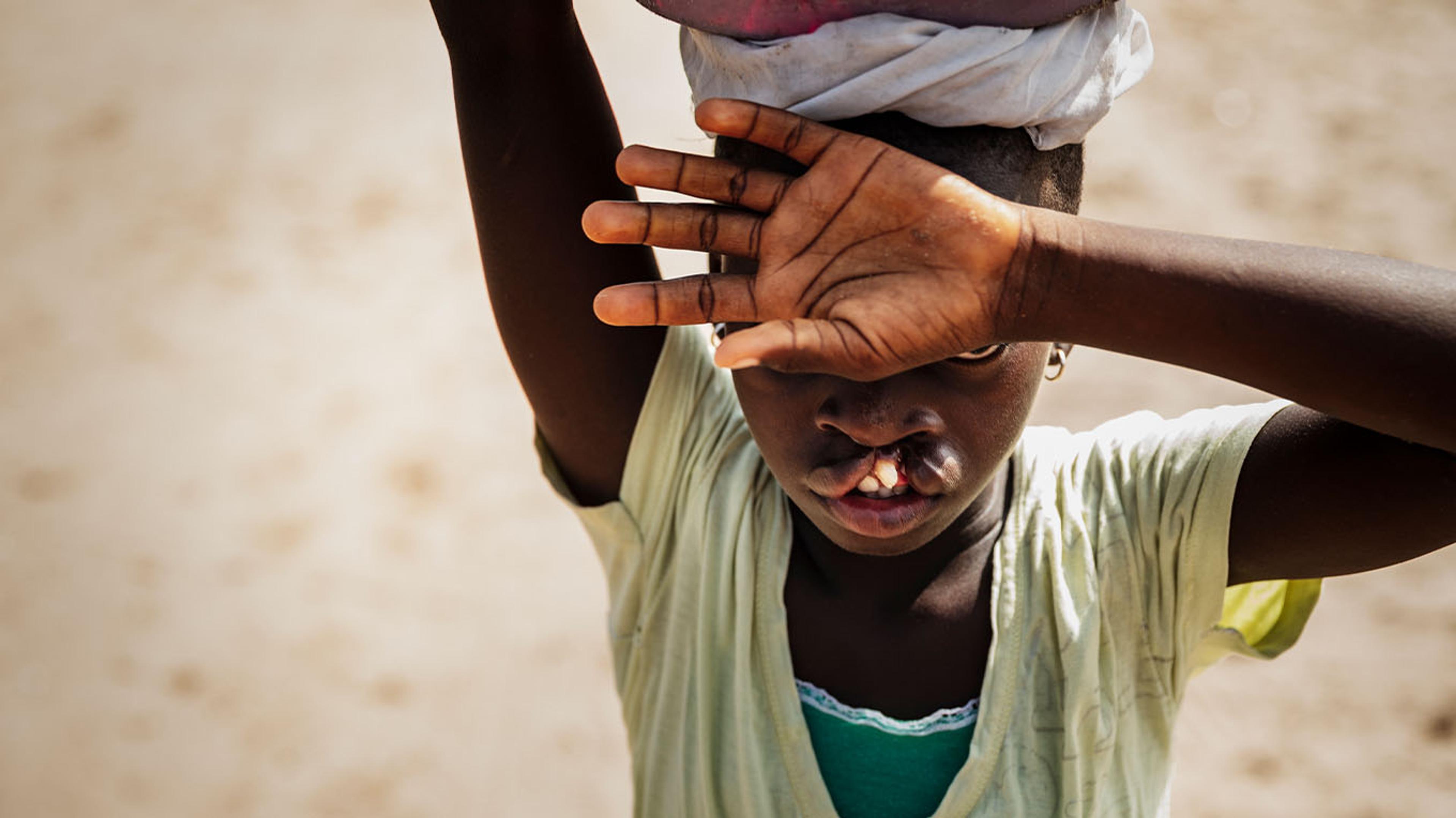 Operation Smile | Jörgen Hildebrandt | Fotografiska Stockholm
