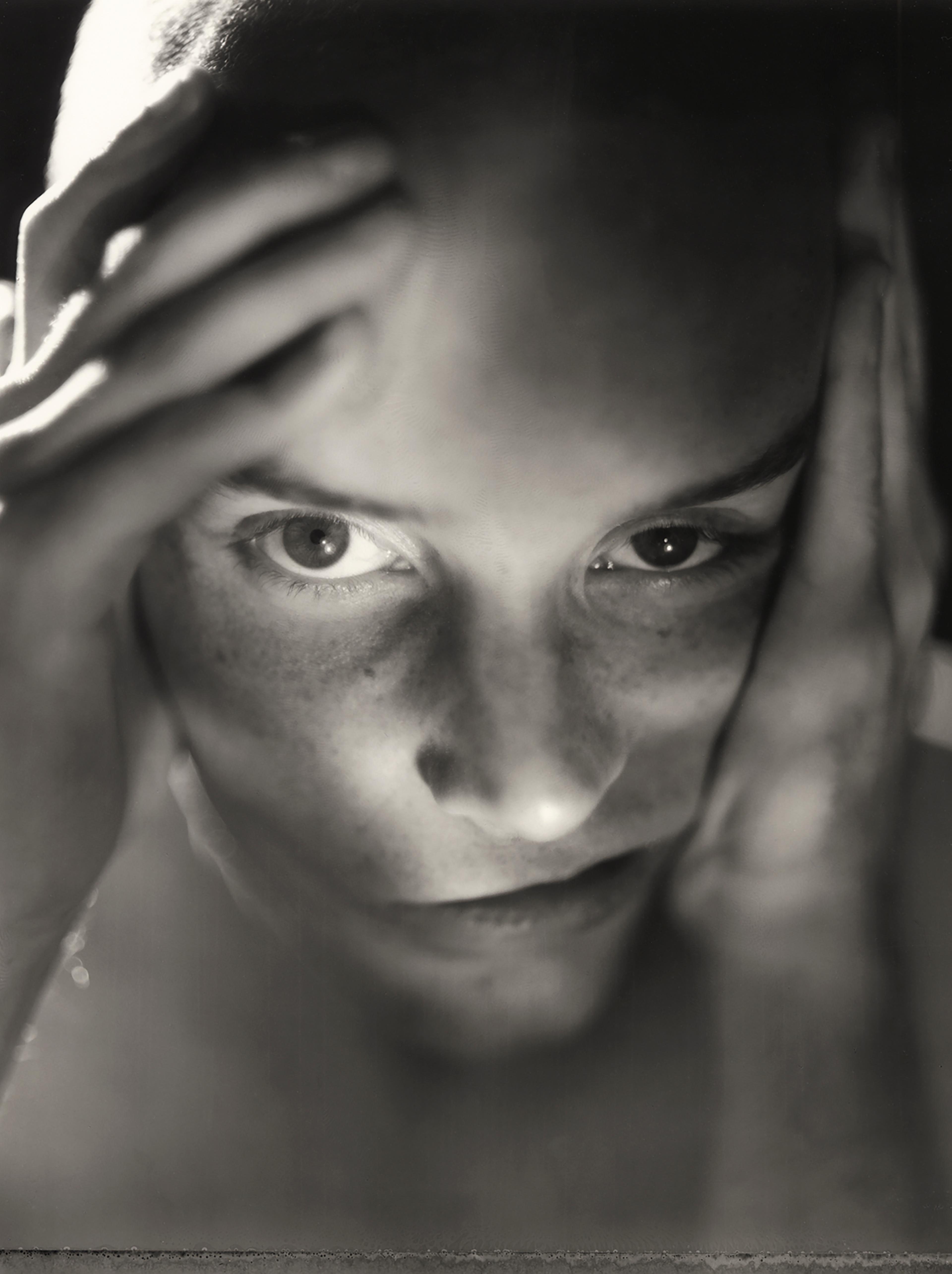 A black-and-white close-up photograph of a face with one hand pulling the skin away from the mouth and another hand resting on the forehead.