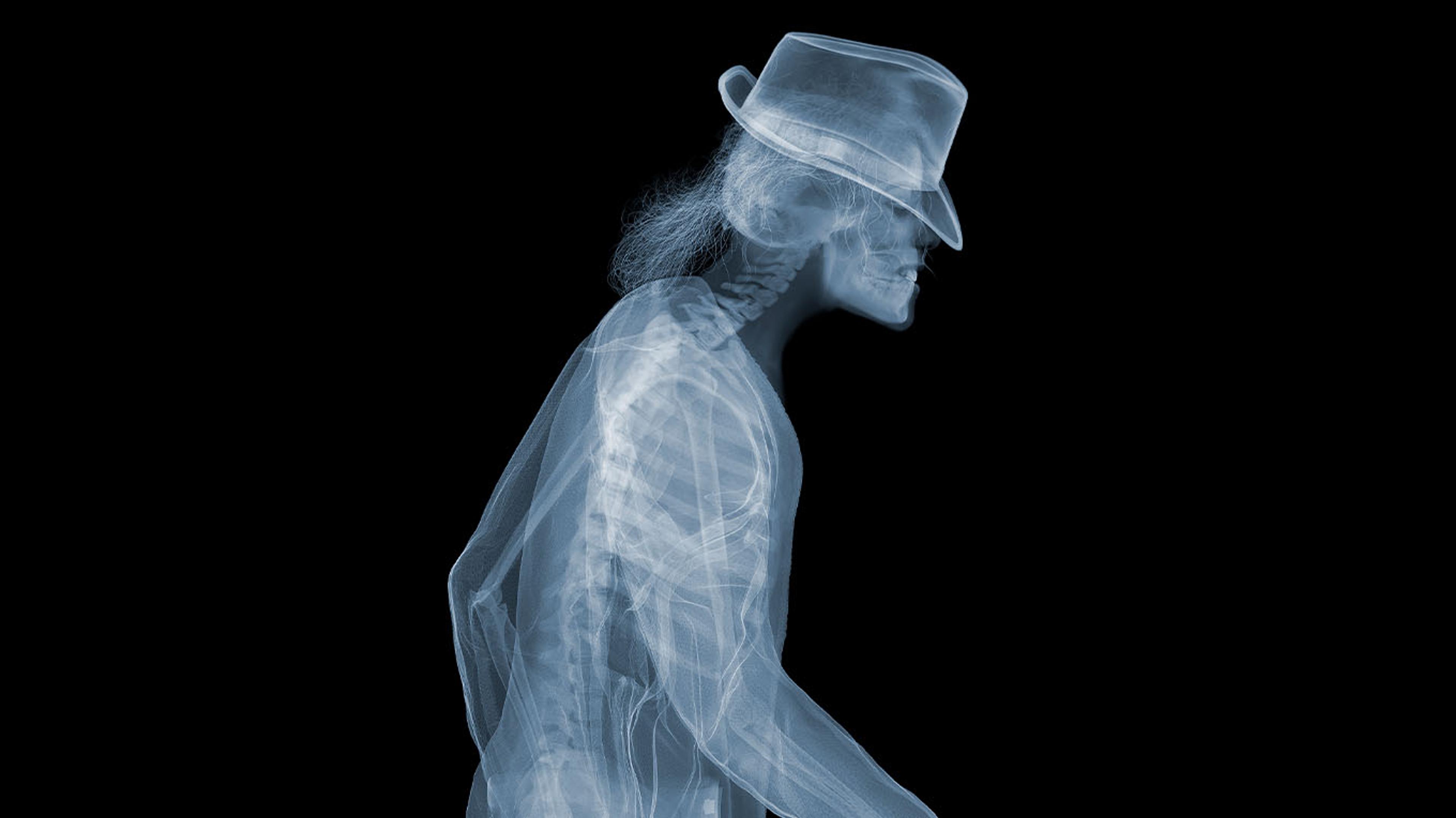 © Artist_Nick_Veasey_ Michael_Jackson
