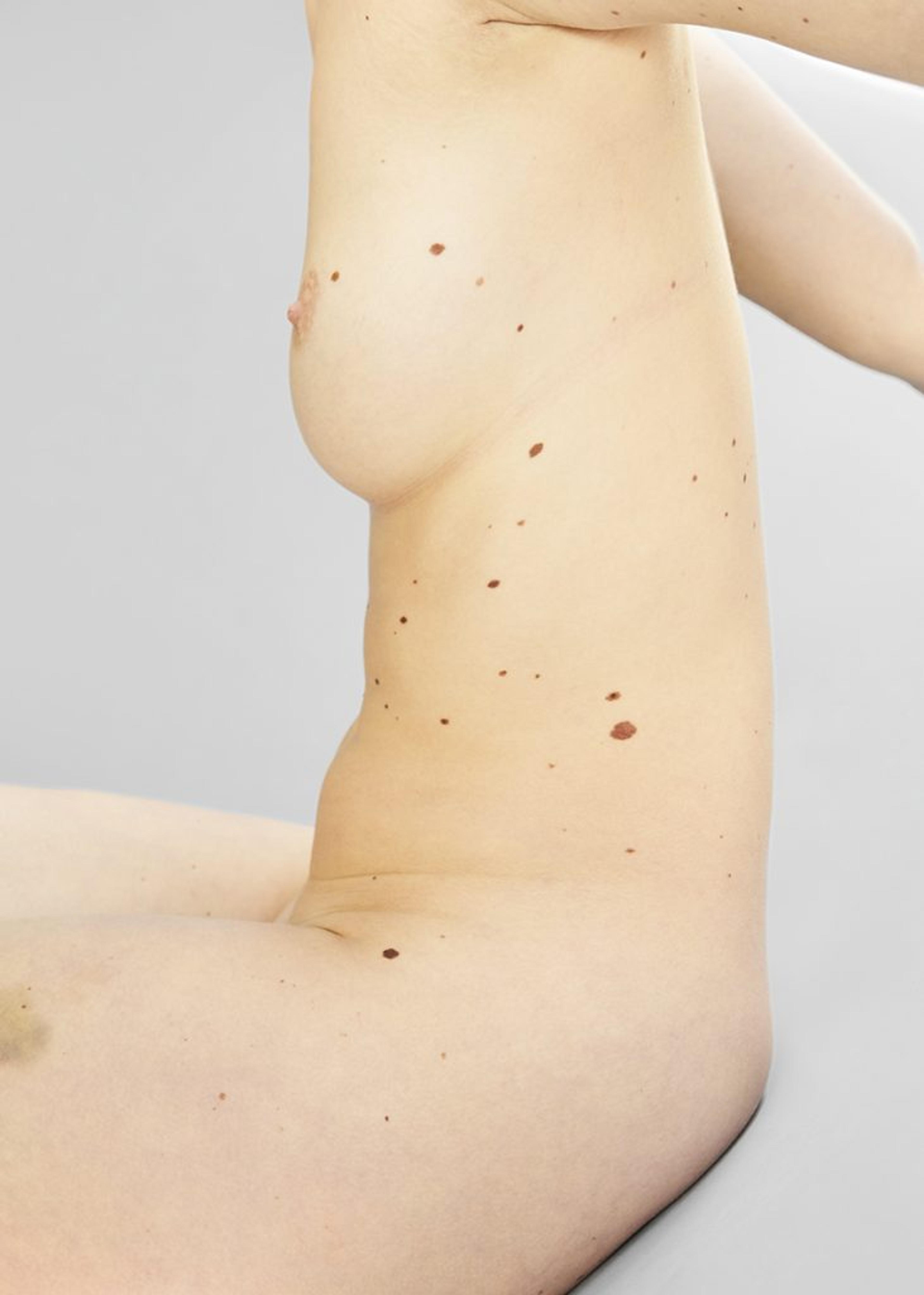 A female figure without clothing, featuring numerous spots covering her body.
