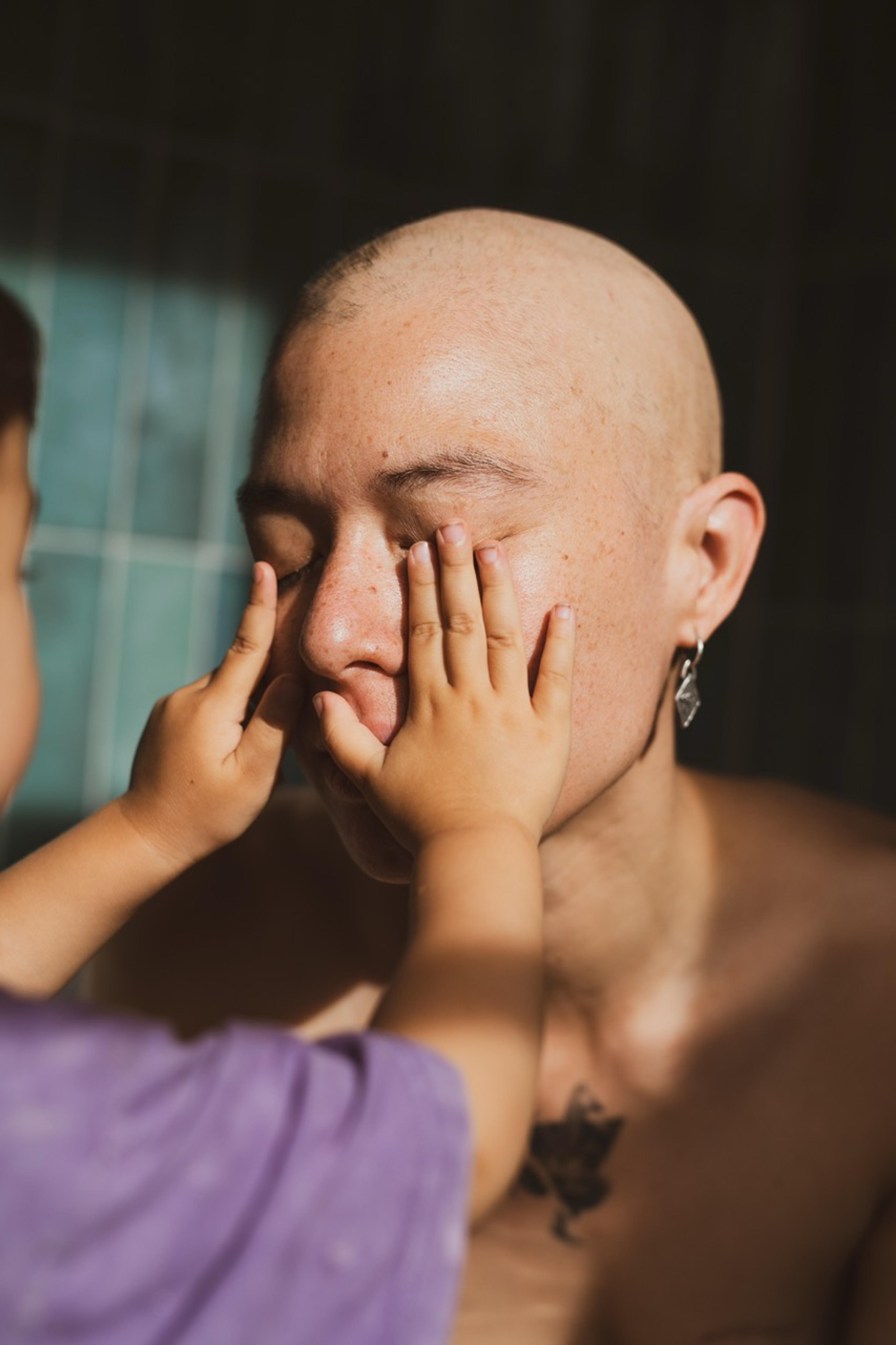 Close-up in sunlight. A child's small hands rest against a bald woman's face while she keeps her eyes closed.