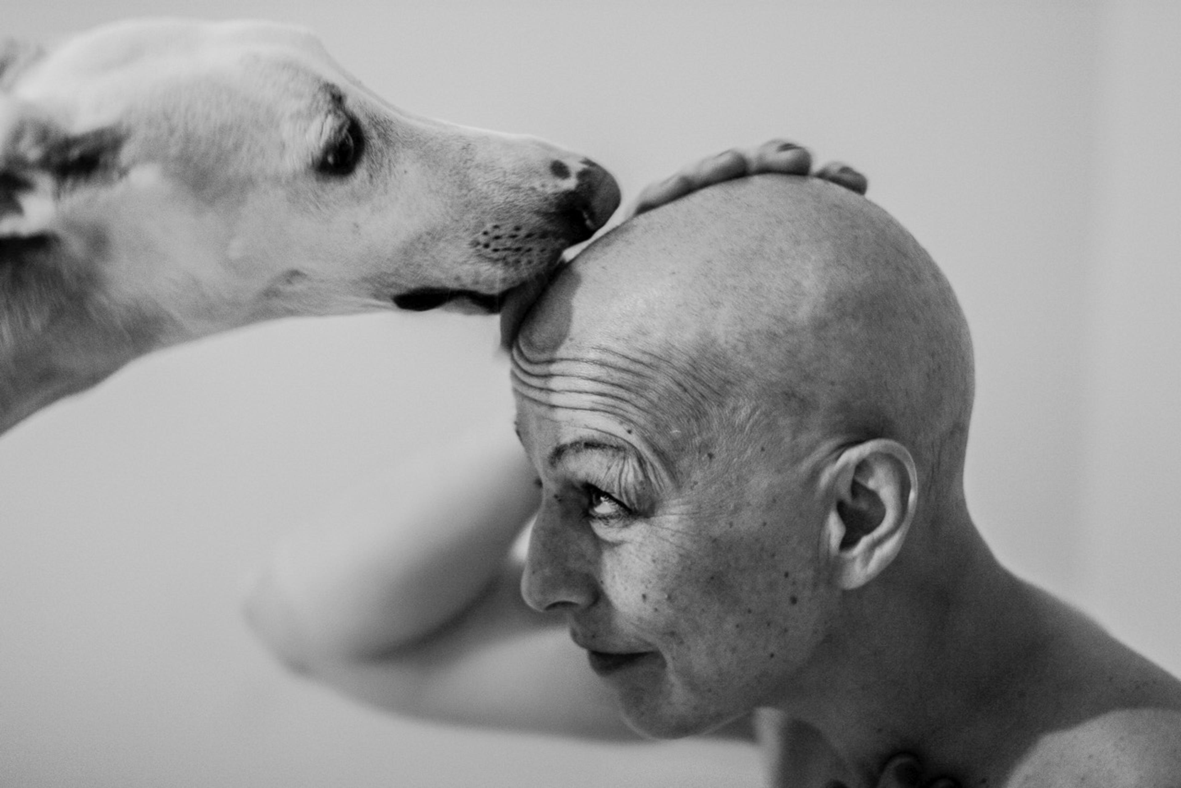Black-and-white close-up in profile. A dog licks the top of a bald woman's head while she keeps her eyes closed with a peaceful expression.